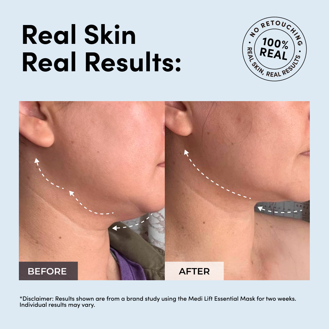 Medi Lift Essential Mask
