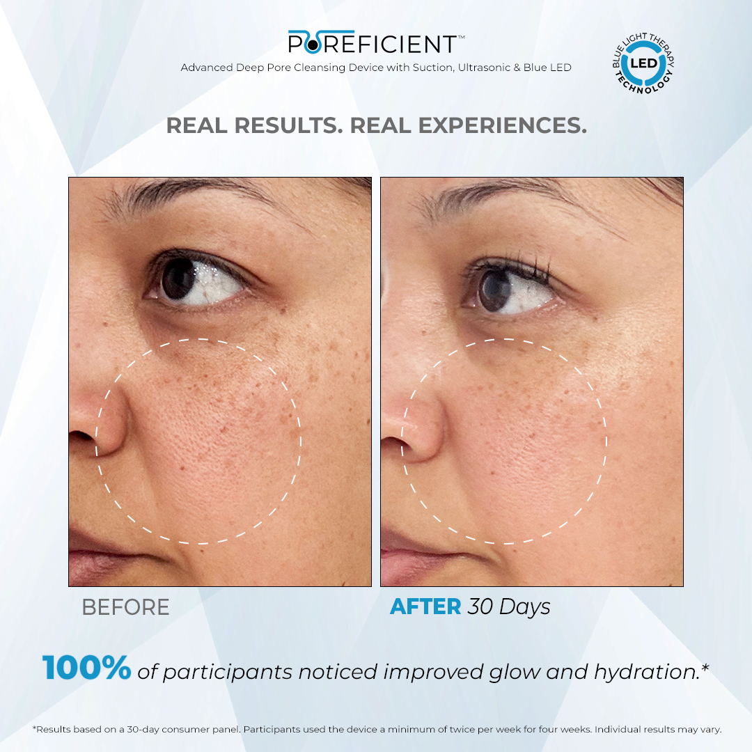 POREFICIENT™ Advanced Deep Pore Cleansing Device with Suction, Ultrasonic & Blue LED