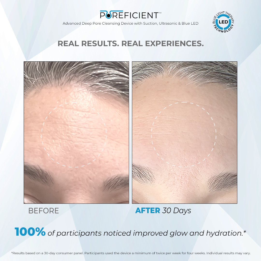 POREFICIENT™ Advanced Deep Pore Cleansing Device with Suction, Ultrasonic & Blue LED
