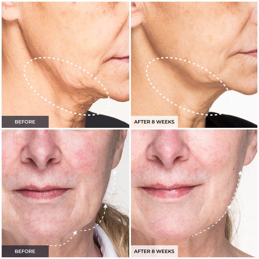 Medi Lift Essential Mask